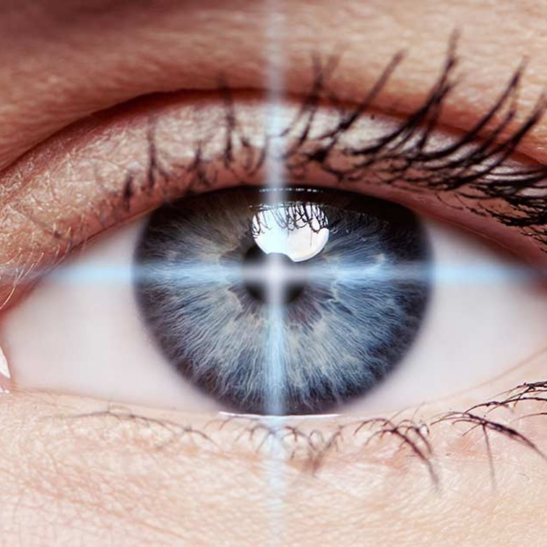 Augenlasern Fokus